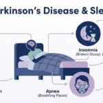 How Parkinson's Affects Your Sleep